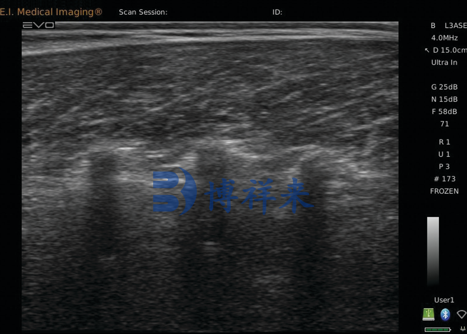 牛肌内脂肪超声印象