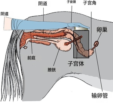 马子宫B超检测 2.jpg