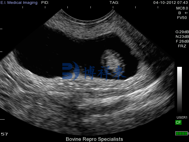 凸阵直肠探头测牛35天超声图
