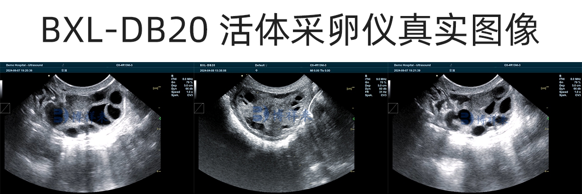 高清牛卵泡抽吸图像，超排卵泡B超图