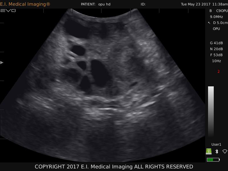 牛卵泡超声图像