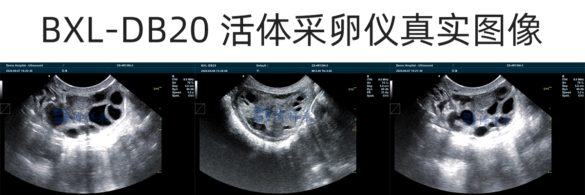 牛活体采卵B超超声