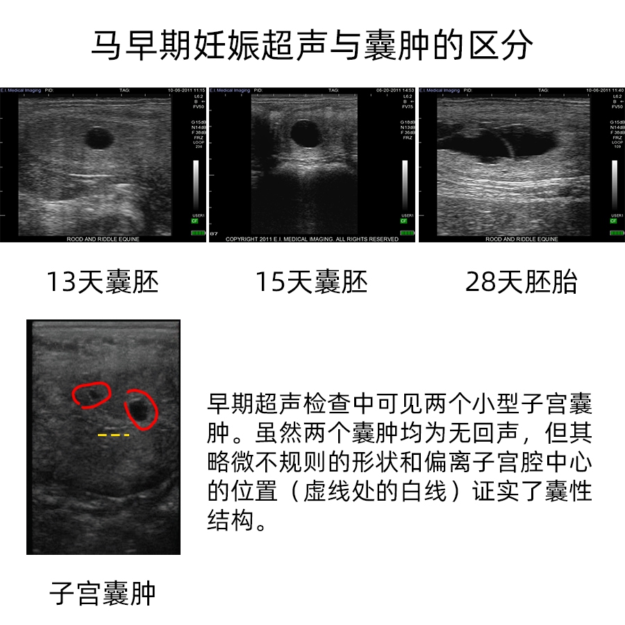 马早期妊娠天数与子宫囊肿的超声对比