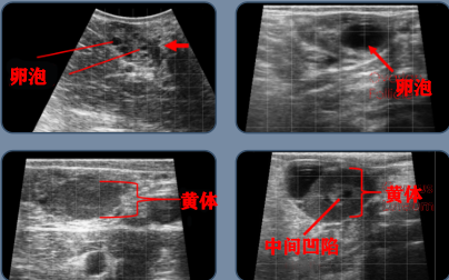 牛用B超检测母牛卵巢发育情况