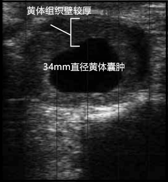 牛用B超检测黄体囊肿