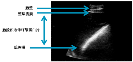 牛肺部炎症超声图像